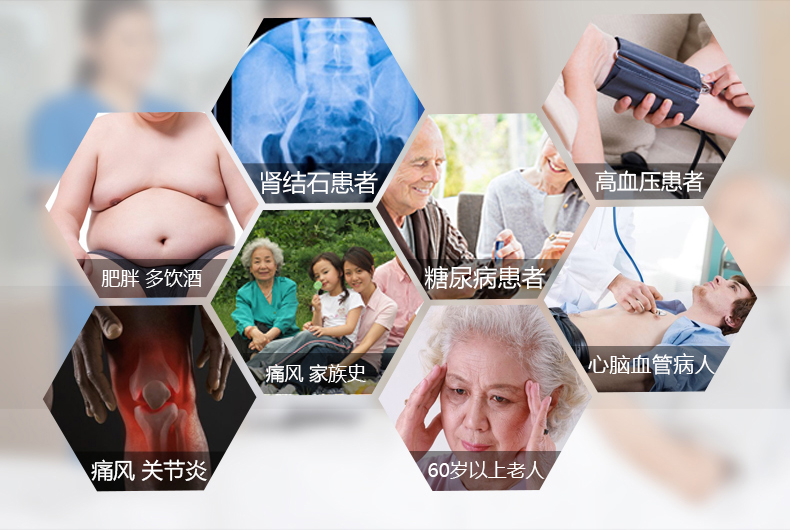優速型血糖尿酸測試儀家用測尿酸 尿酸儀