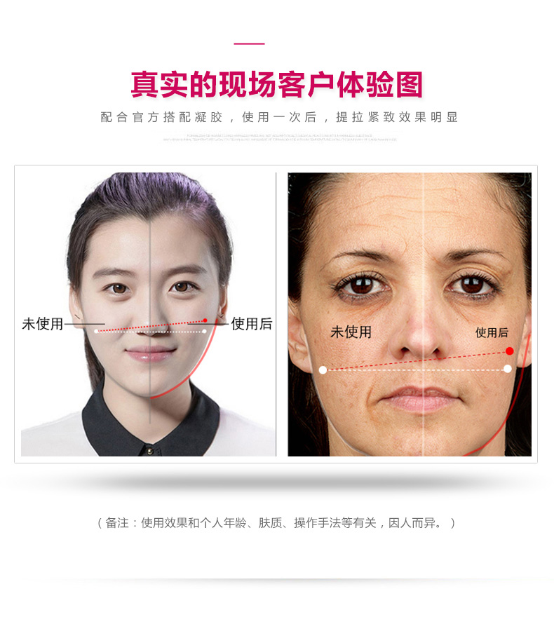 日本娜蜜絲nanoskin嫩膚儀美容儀器家用 臉部射頻瘦臉導入導出